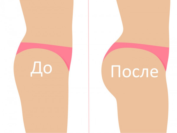 Бразильская попа. Как сделать в домашних условиях