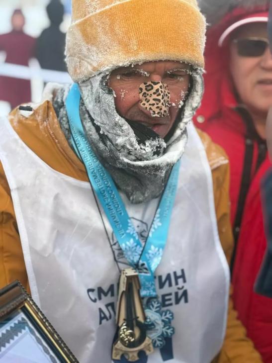 Футболист Алексей Смертин едва не лишился пальца во время марафона в Оймяконе при -42 градусах Футболист Алексей Смертин едва не лишился пальца во время марафона в Оймяконе при -42 градусах